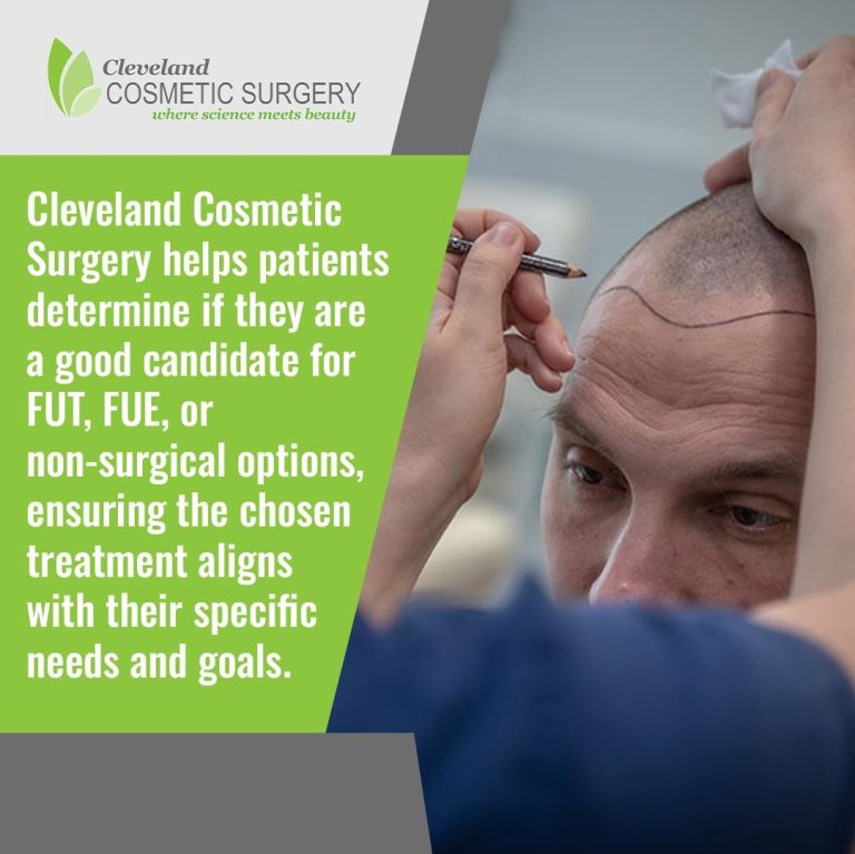 Featured image for Auto-prepared featured image